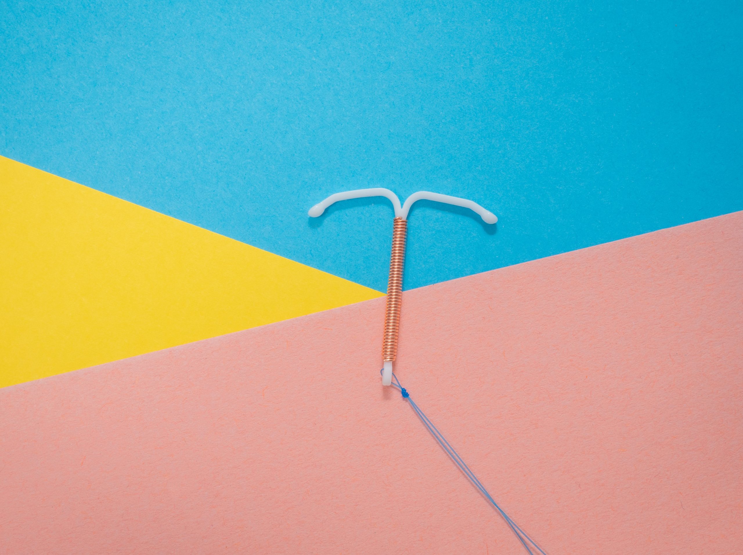 A picture of an intrauterine device (IUD), otherwise known as the coil